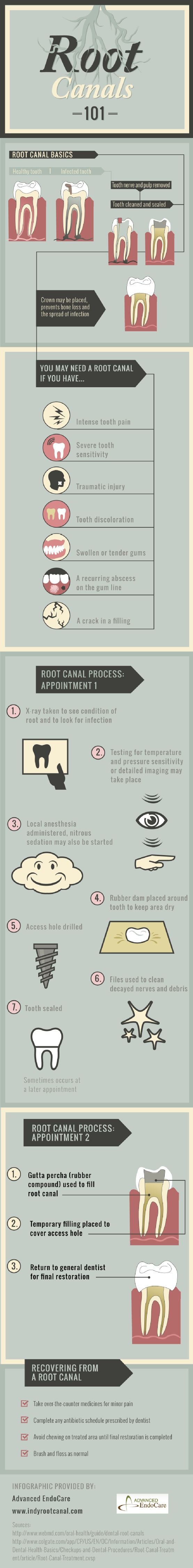 Root Canal 101