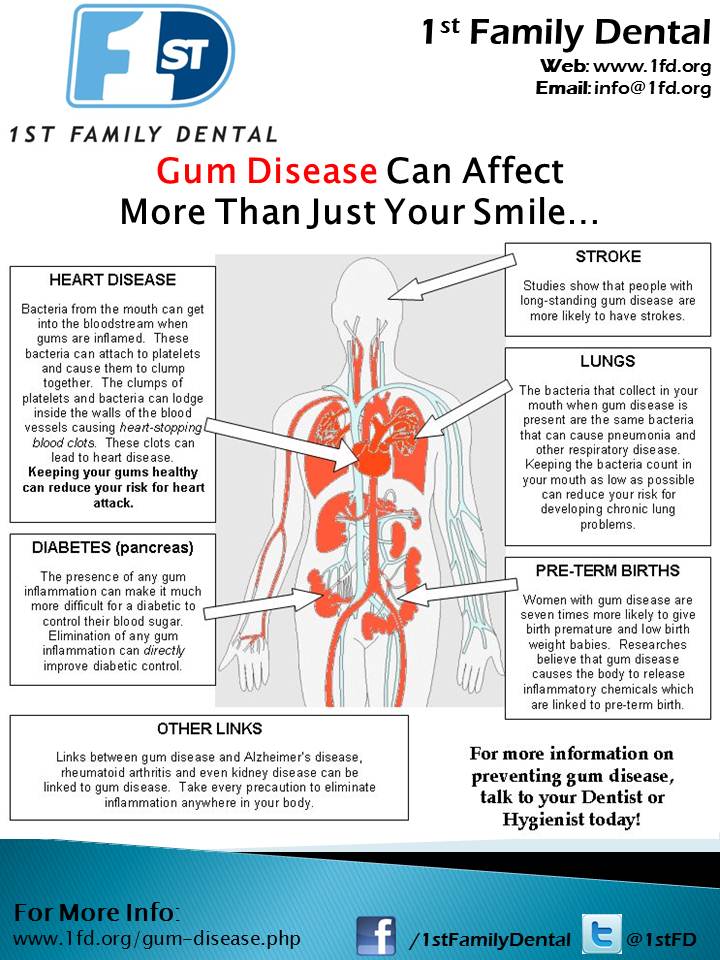 Gum Disease & Whole-Body Health